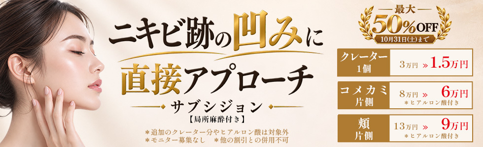 ニキビ跡の凹みに直接アプローチ★サブシジョン★最大50%OFF